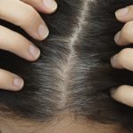 7 Foods That Cause Grey Hair